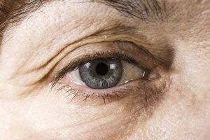Tips to protect your eyes as you age